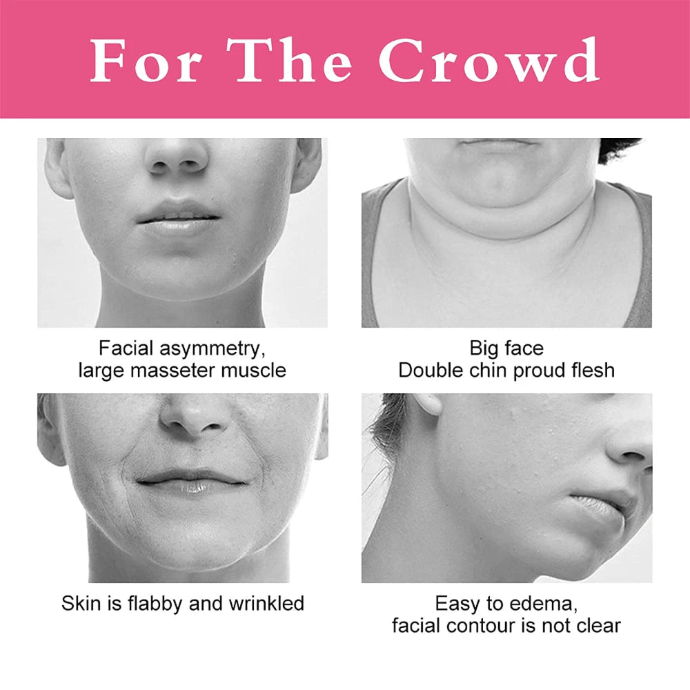V-Lift™ Face Strap